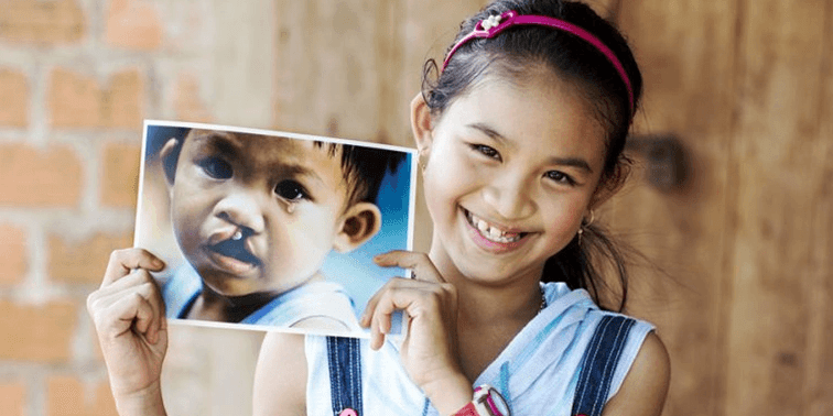 Operation Smile Sverige